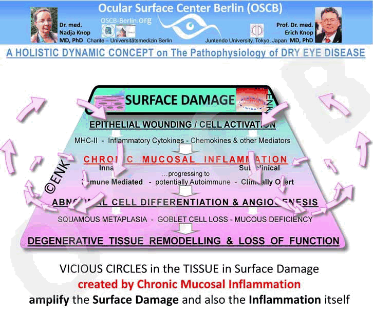 Auch die Primäre Pathologie des GEWEBESCHADENS der Augenoberfäche wird durch Sequenzen SEKUNDÄRER PATHOGENETISCHER FAKTOREN reguliert und verschlimmert. Bei einem Gewebeschaden tritt typischerweise eine entzündliche Reaktion ein als grundlegende Verteidingsstrategie jedes Gewebes. Wenn der Gewebeschaden chronisch wird, was beim Trockenen Auge oft der Fall ist, dann kann es zu einer CHRONISCHEN ENTZÜNDUNGSREAKTION kommen, die wiederum mächtige selbstverstärkende Regelkreise (Vicious Curcles - hier als drehende Pfeile dargestellt) der Gewebeschädigung in Gang setzen kann. Dies stellt den Übergang von der akuten Reizung zu einer Chronischen Entzündung dar und damit den Übergang von einem `Trockenen Auge´zur ´Erkrankung des Trockenen Auges´.