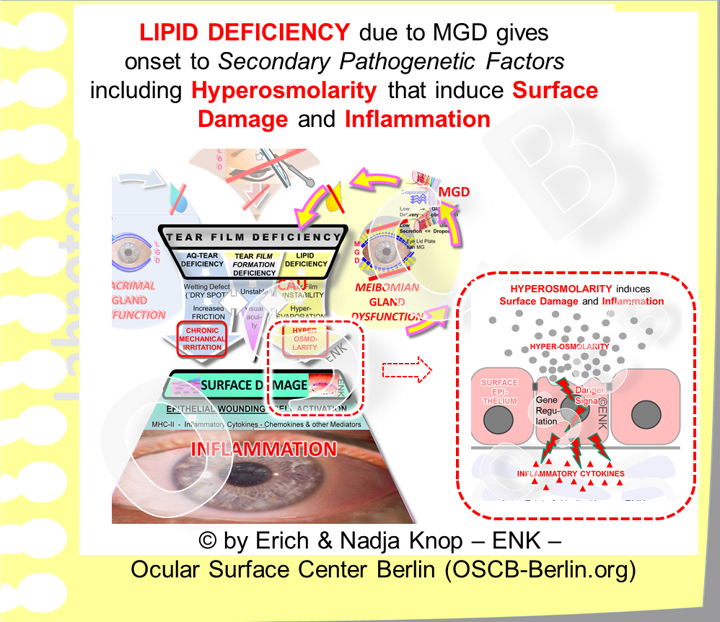 In the Pathogenesis of Dry Eye Disease , HYPER-OSMOLARITY (inset to the right) is an important SECONDARY PATHOGENETIC FACTOR , that is induced by the PRIMARY PATHOLOGY of a LIPID DEFICIENCY in the tear film with increased evaporation of the aqueous phase of the tears. These Pathologies are based on the BASIC CAUSATIVE FACTOR of a GLAND-DYSREGULATION - in this case: in Meibomian Gland Dysfunktion (MGD) . Pathologies of the aqueous secretion , on the other hand, which are not considered here, are induced by a Dysreguation of the aqeuous Lacrimal Gland .