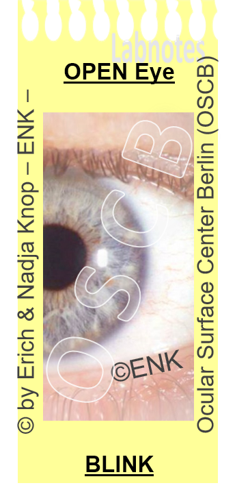 OSCB-Berlin.org_Augenoberfläche_Ocular Surface for HA High Viscosity vs. Low Viscosity.png