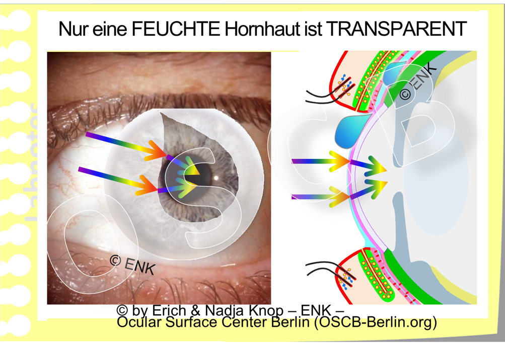 TRÄNEN bewirken die FEUCHTIGKEIT der Augenoberfläche, die eine Vorbedingung ist für ihre Gesundheit und Intaktheit - und daher auch für die TRANSPARENZ der Hornhaut/ Kornea.