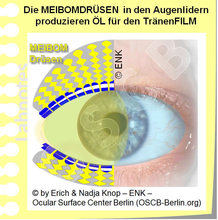 Zahlreiche einzelne Meibomdrüsen (gelb) befinden sich in den Tarsalplatten von Ober- und Unterlid, die der Verstärkung der Lider dienen, und füllen diese weitgehend aus. Damit liegen sie Meibomdrüsen recht verborgen und sind den üblichen klinischen Untersuchungstechniken meist verborgen. Vor allem ihre Ausführungsgangöffnungen sind als kleine Punkte weit hinten am Lidrand erkennbar.