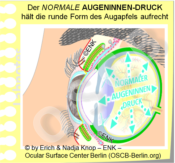 Der normale Augeninnendruck von etwa 15 mmHg (Millimeter Quecksilbersäule) ist notwendig um die normale runde Form des Auges aufrecht zu erhalten.