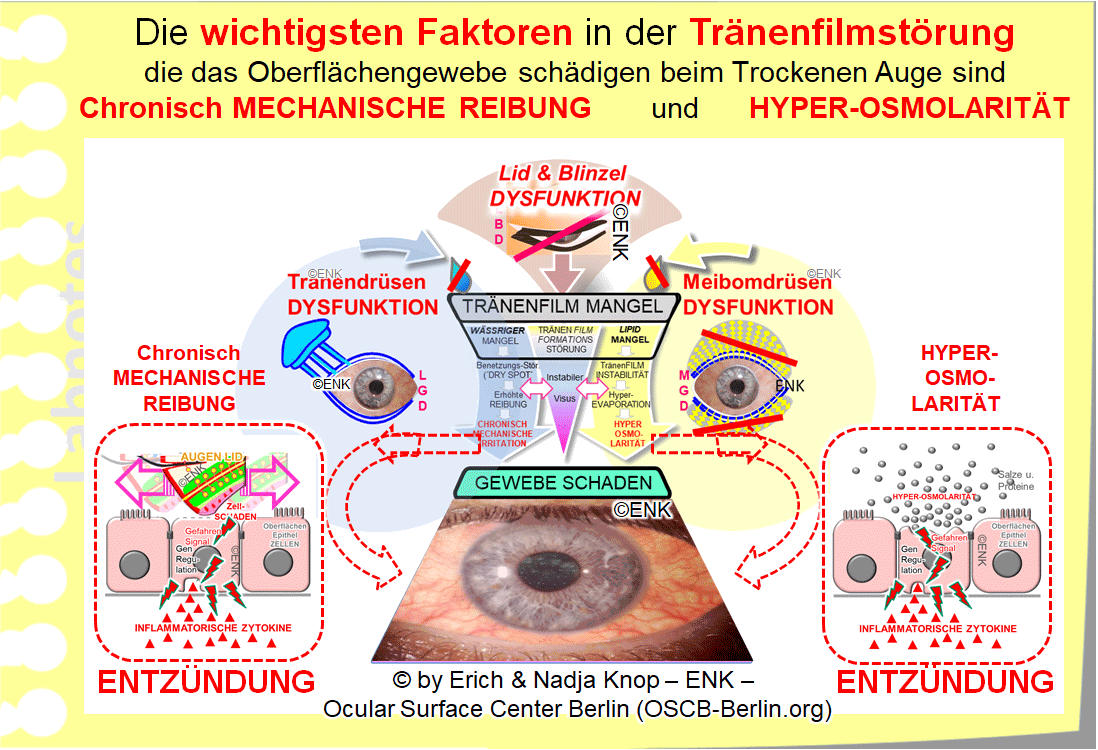OSCB-Berlin.org_Erhöhte-mechanische-REIBUNG-verursacht-eine-Gewebe-Schädigung-3D.gif