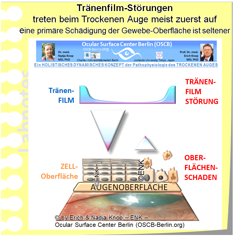GIF-Animation-GRUNDLEGENDE-KAUSALE-FAKTOREN-für-das-TROCKENE-AUGE_DEUTSCH_Einzel-BILDER_400pix-32-2_.gif