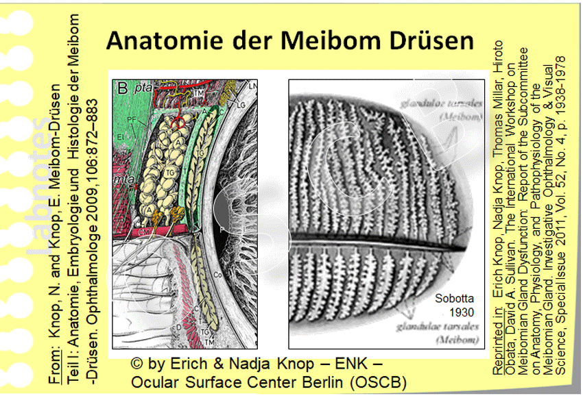 Meibom-drüsen Selbst Ausdrücken: Mdd Berlin Fullsize Oscb