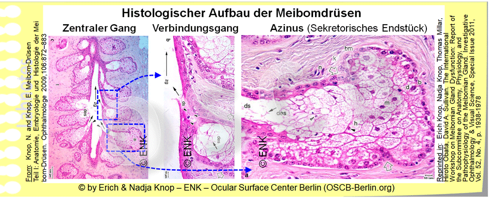 Histologischer Flachschnitt durch eine Meibomdrüse , sie ist etwa in der Mitte getroffen in Höhe des zentralen Ganges . Von dort gehen zahlreiche kleine Verbindungsgänge zu den Seiten, wo die Öl-produzierenden Zellen (Meibozyten) in den rundlichen sekretorischen Azini liegen. Das Sekret fliesst von dort durch die Verbindungsgänge in den zentralen Gang in Richtung der Drüsenöffnung (hier oben gelegen)