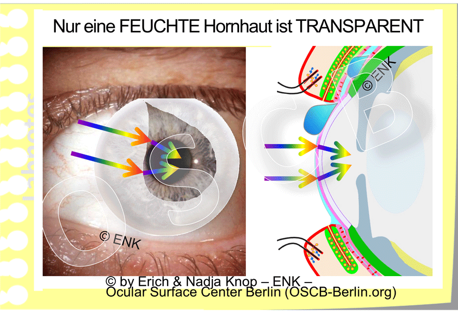 OSCB-Berlin.org_Nur-eine-FEUCHTE-Hornhaut-ist-TRANSPARENT_WEB_.gif