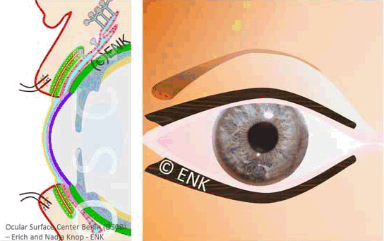OSCB-GIF_BLINZELN, BLINK Animation (QUER + FRONTAL)_1-7_PSD-JPGs + PPT-Folien + TEXT + TRÄNENFLUSS (20cm-72dpi)_33-10fps GIF.gif