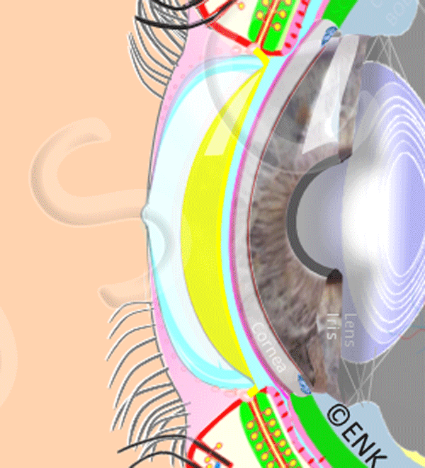 ANIMATION-HAUPT-PATHOLOGIEN-bei-MGD_mit-ZETTEL-+-OSCB-+-TITEL-DEUTSCH_ZUGESCHNITTEN-NUR-CORNEA.gif