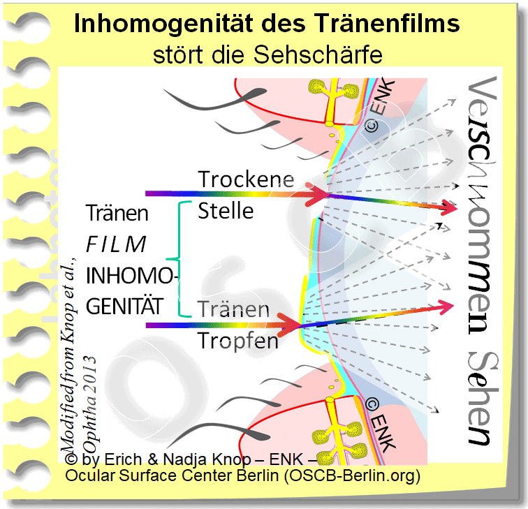 OSCB-Berlin.org_INHOMOGENITÄT-des-TränenFILMs-stört-die-Sehschärfe.gif