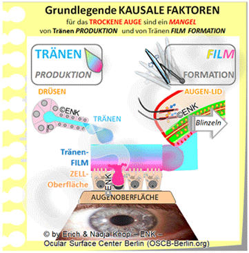 GIF-Animation-GRUNDLEGENDE-KAUSALE-FAKTOREN-für-das-TROCKENE-AUGE_DEUTSCH_Einzel-BILDER_400pix-32-2_.gif