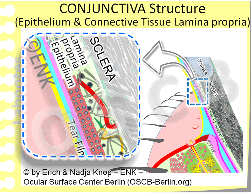 The schematic structure of the bulbar CONJUNCTIVA near the corneal margin (limbus). At the bottom of the Tear Film is the epithelium of the conjunctiva that seals its underlying connective tissue layer (Lamina propria). The loose connective tissue in the Lamina propria is composed of loosely arranged collagen fibers and contains many cells as well as blood vessels (red) and nerve fibers. It is sitting on the densely arrange collagen of the underlying Sclera - the solid wall of the Eye Ball.
