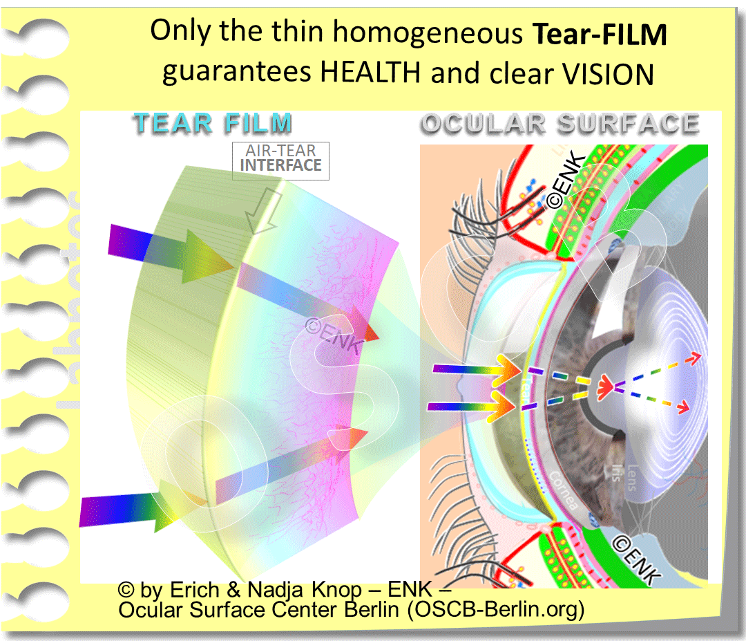 The AIR-To-TEAR INTERFACE of the Tear FILM is the MAIN Surface for REFRACTION
