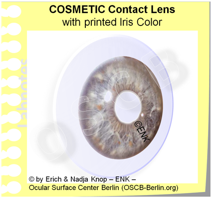 OSCB-Berlin.org_(c)ENK_Trockenes-Auge,-Dry-Eye-Disease,-Contact-Lens,-Kontaktlinse_COSMETIC-Contact-Lens-with-printed-Iris-Color_2.png