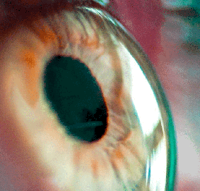 The Cornea Ocular Surface Center Berlin - 