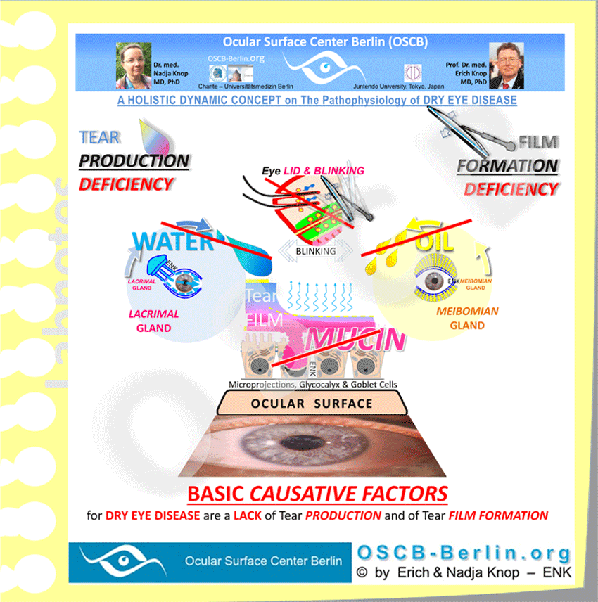 Dysfunctions in Tear SECRETION and in Tear FILM FORMATION are the Basic Causative Factors for the onset of Dry Eye Disease because they impair the ability of the Ocular Surface to provide a permanent moist coating in all zones, including the Cornea and Conjunctiva in the opened palpebral fissure ... which typically leads to Surface Tissue Damage.