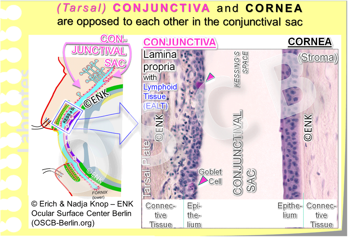 The tarsal plate with the included Meibomian Glands is in immediate vicinity of the conjunctiva - directly underneath the narrow connective tissue of the conjunctival lamina propria and only about 0,1mm from the lumen of the conjunctival sac.