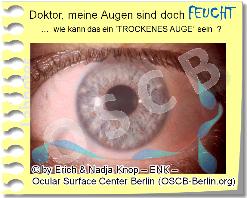 OSCB-Berlin.org_(c)ENK_Trockenes-Auge,-Dry-Eye-Disease,-Contact-Lens,-Kontaktlinse__DOKTOR,-meine-Augen-sind-doch-FEUCHT-...-wie-kann-das-ein-TROCKENES-AUGE-sein.gif
