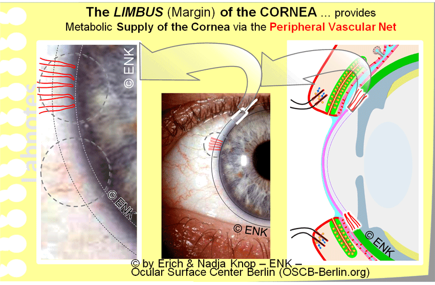 The CORNEA — Ocular Surface Center Berlin
