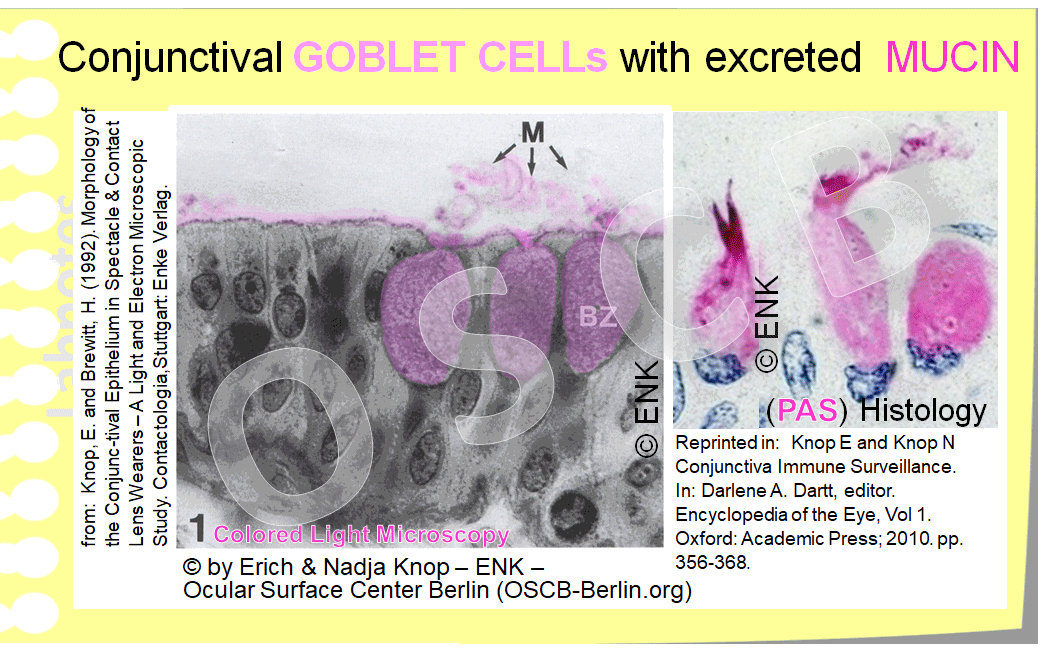 The marginal CONJUNCTIVA in the LID WIPER region is multi-layered with up to 10 epithelial cell layers and cuboidal to columnar at the surface - goblet cell of the built-in lubrication system of the LID WIPER are interspersed at the surface and, as a novel finding, also within goblet cell crypts in the depth of the epithelium.