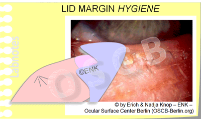 GIF Animation_LID-MARGIN-HYGIENE,-ENGLISCH_KLEIN-400pix-+-UNREGELMÄSSIG_36-0,1_.gif