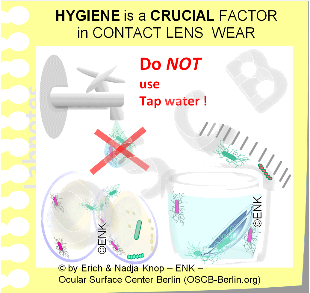OSCB-Berlin.org_HYGIENE-is-a-CRUCIAL-FACTOR-in-CONTACT-LENS--WEAR.gif