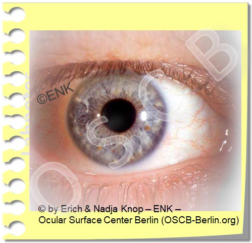 Copy of The OCULAR SURFACE