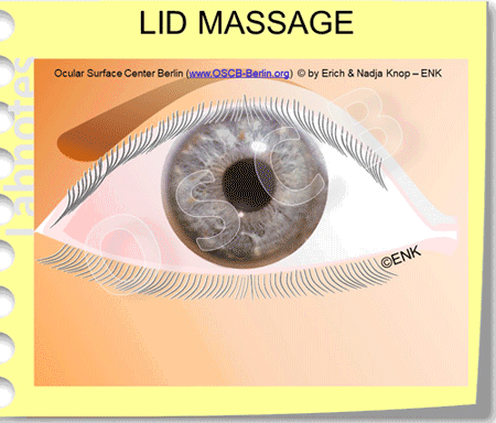 OSCB_LIDER-(FRONTAL)-Animation-(ENK)-LIDRANDMASSAGE_aus-BLINZELN_(aus-KL-Weich)__4____MIT-OSCB+ZETTEL---FERTIG.gif