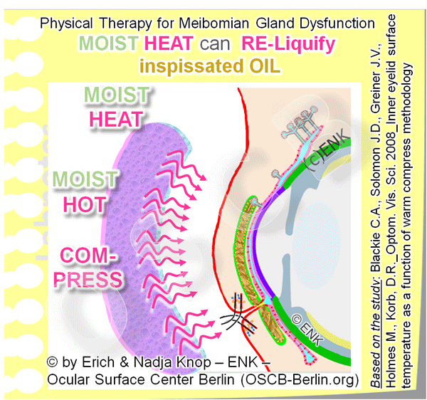GIF-Animation-PHYSIKALISCHE-THERAPIE,-WÄRMUNG-u.-ev.-Expression-der-Meibomdrüsen-und-Augenlider_Einzel-BILDER_600pix-16-2_ENGLISCH.gif