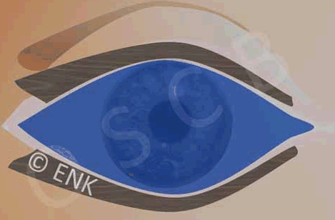 OSCB, ENK_LIDER (FRONTAL) Animation BLINZELN__DRY SPOT FLUO_KLEIN 20cm-72dpi_10fps GIF.gif