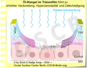 Copy of PATHO-MECHANISM of Dry Eye Disease