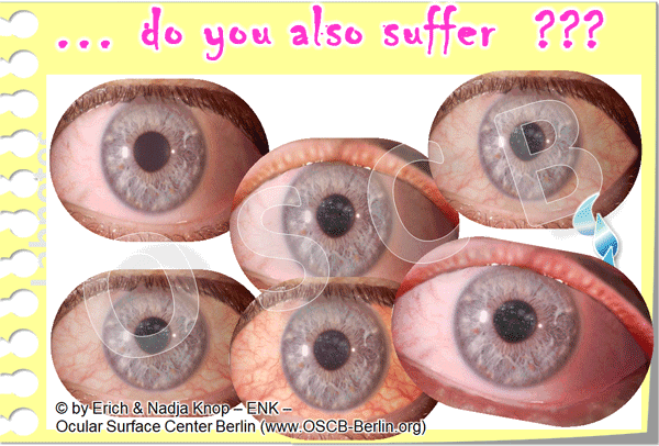 Animation-UNSCHARF-Sehen-(aus-Animation-Trockenes-Auge,-Dry-Eye)_NEU-600-6-0,5_.gif