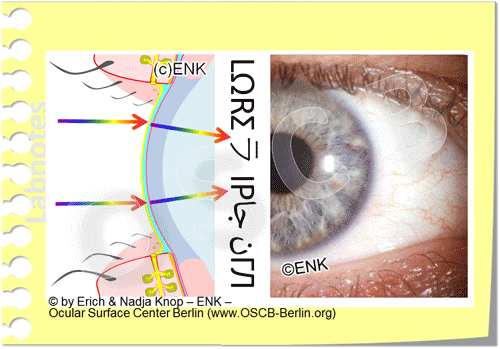 JPN - Dry Eye Facts Index — Ocular Surface Center Berlin