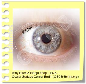 ورقة الحقائق<br>حول مرض العين الجاف