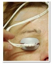 TearScience LIPIFLOW Patient + Applicator.jpg