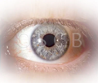 English HOME Page – Ocular Surface Center Berlin