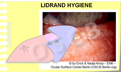 GIF-Animation_LIDRAND-HYGIENE_Einzel-BILDER_KLEIN-400pix_UNREGELMÄSSIG_400pix-34-0,1_.gif