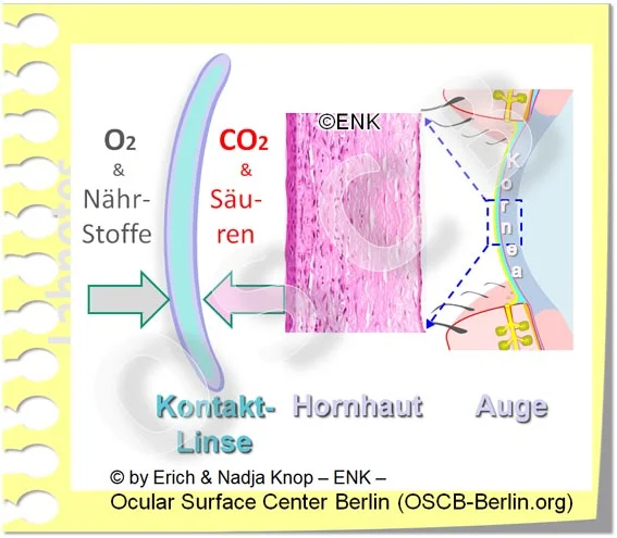 Kontaktlinsen hemmen die Versorgung und Entsorgung der Hornhaut mit wichtigen Substanzen. Wie das lichtmikroskopische Bild (Mitte) der Hornhaut zeigt, ist sie ein kompliziert aufgebautes Gewebe , das nur solange durchsichtig bleibt wie es nicht beschädigt wird.