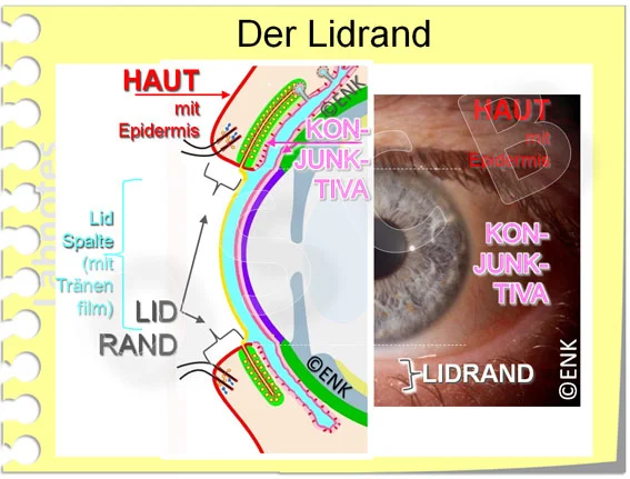 Augenlid Anatomie Tarsalplatte Obere Lidplatte E Anatomy IMAIOS augenlid-anatomie-tarsalplatte-obere-lidplatte-e-anatomy-imaios