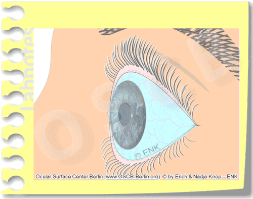 Animation_Trockenes-Auge+Gefässe+Rötung,-Dry-Eye_Einfach,-Zum-Einstieg-für-FACTS_Zugeschnitten+600_15-600-0,3.gif