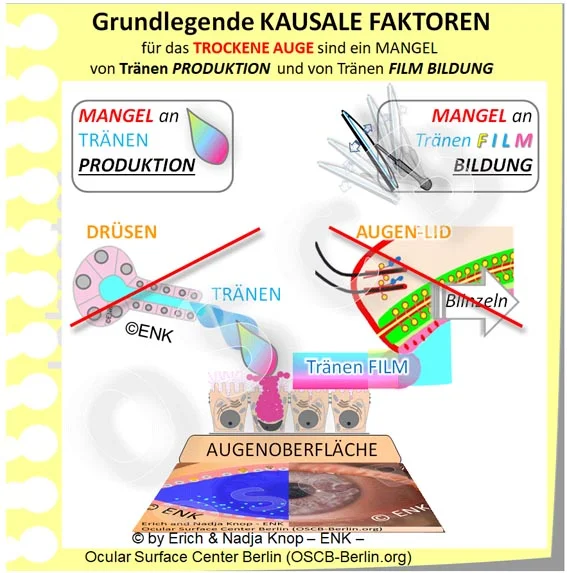 OSCB-Berlin.org_Grundlegende-KAUSALE-FAKTOREN-für-das-TROCKENE-AUGE-sind-ein-MANGEL-von-Tränen-PRODUKTION-und-von-Tränen-FILM-BILDUNG---EINFACH--NEU_20_JPG6_.jpg