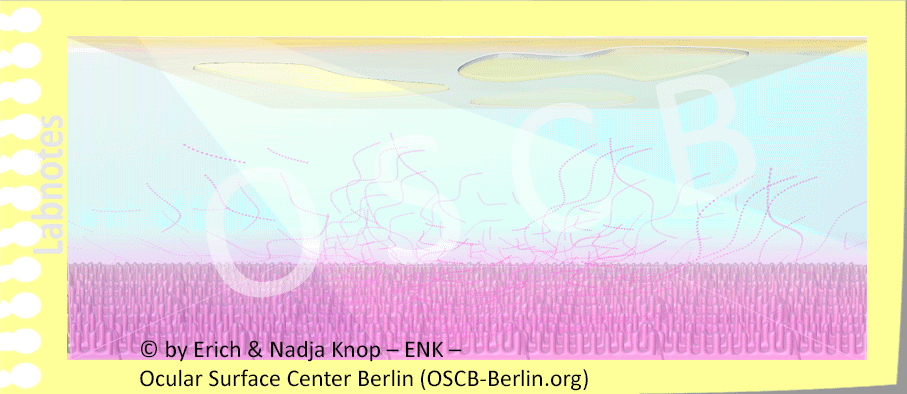 GIF-OSCB-Berlin.org_Dry-Eye-Trockenes Auge, (c)ENK, TEAR FILM, Tränenfilm-AQUARIUM-AUF-ZETTEL-montiert,-900pix,-9-0,5_.gif