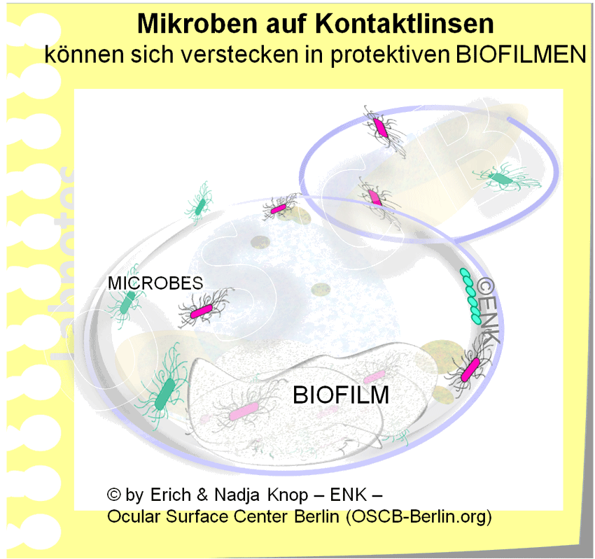 OSCB-Berlin.org_(c)ENK_Trockenes-Auge,-Dry-Eye-Disease,-Contact-Lens,-Kontaktlinse_MIKROBEN-auf-Kontaktlinsen-können-sich-verstecken-in-protektiven-BIOFILMEN.gif