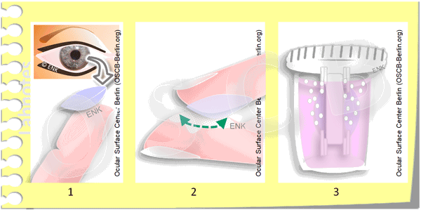 (c)-OSCB,-ENK-Erich-und-Nadja-KNOP_CONTACT-LENS-CLEANING-and-DISINFECTION_-ANIMATION-Kontaktlinsen-REINIGUNG-und-DESINFEKTION-2__600-4-0,3.gif