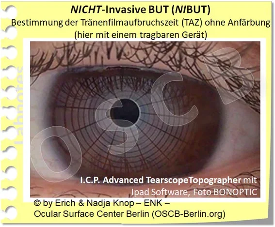 OSCB-Berlin.org, (c) ENK_Dry Eye Disease, Contact Lenses_Trockenes Auge_NICHT-Invasive BUT (NIBUT)_20__.jpg