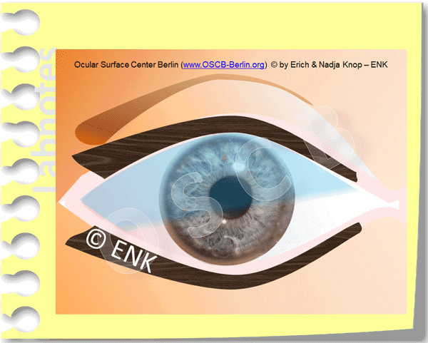 ANIMATION_OSCB_LIDER-(FRONTAL)-Animation-(ENK)_aus-BLINZELN_(aus-KL-Weich)_Folie-VERKL.25b-x-25cm-h-ALS-Grösse-Opt.+NEU-MAN_600-13-0,2_+(1).gif