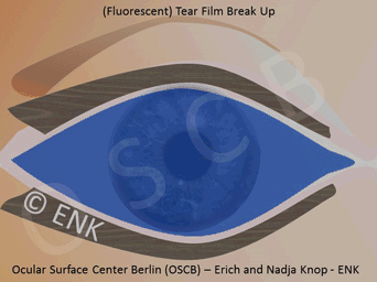 TEXT+KOMM_OSCB, ENK_LIDER (FRONTAL) Animation BLINZELN_(aus KL Weich)_Folie VERKL.25b x 25cm h ALS Grösse Opt.+NEU MAN.Verschob_DRY SPOT FLUO (15cmx72dpi) UP-DOPPELT 36-10fps GIF.gif
