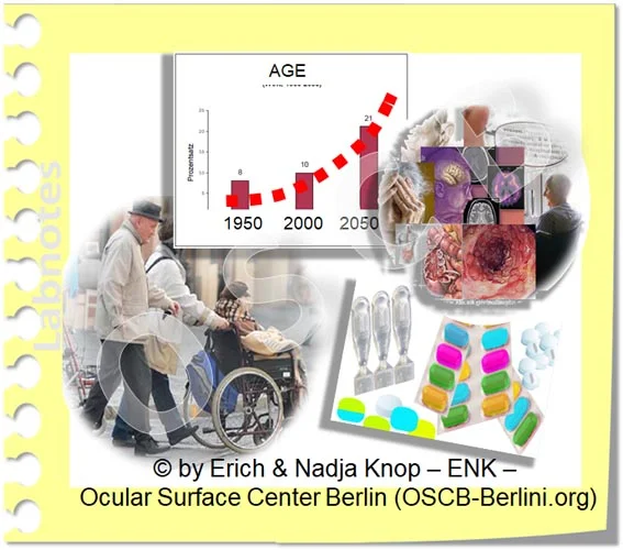OSCB-Berlin.org_(c)ENK_Trockenes-Auge,-Dry-Eye-Disease,-Contact-Lens,-Kontaktlinse___Risikofaktoren ALTER u. Chronische Erkankung_10 LINK BILDCHEN OHNE Text_.jpg