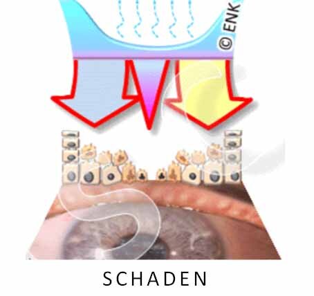 Information-6-SCHADEN_Neu2_.jpg