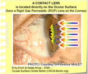 OPTICAL ADVANTAGES